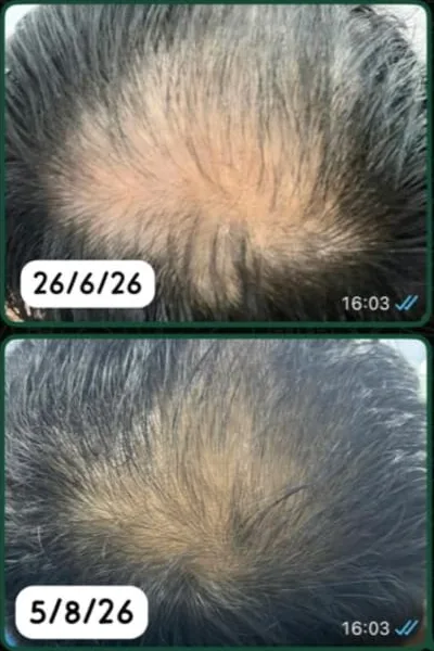 Top of a customer's head, photo dated 26 June 2026 above a photo dated 5 August 2026